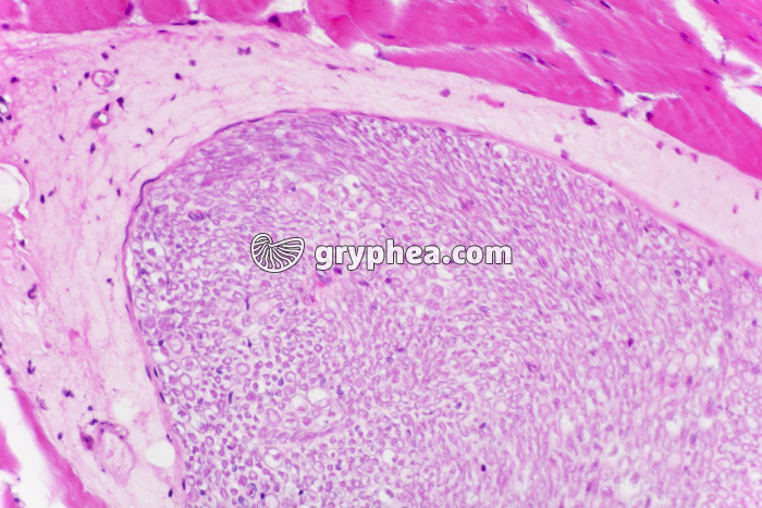 Nerf épiglotte x100 - gryphea.com